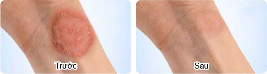 Phòng Khám Da Liễu Quận 5