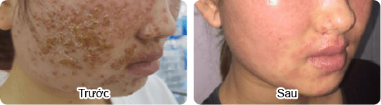 Phòng Khám Da Liễu Quận 5